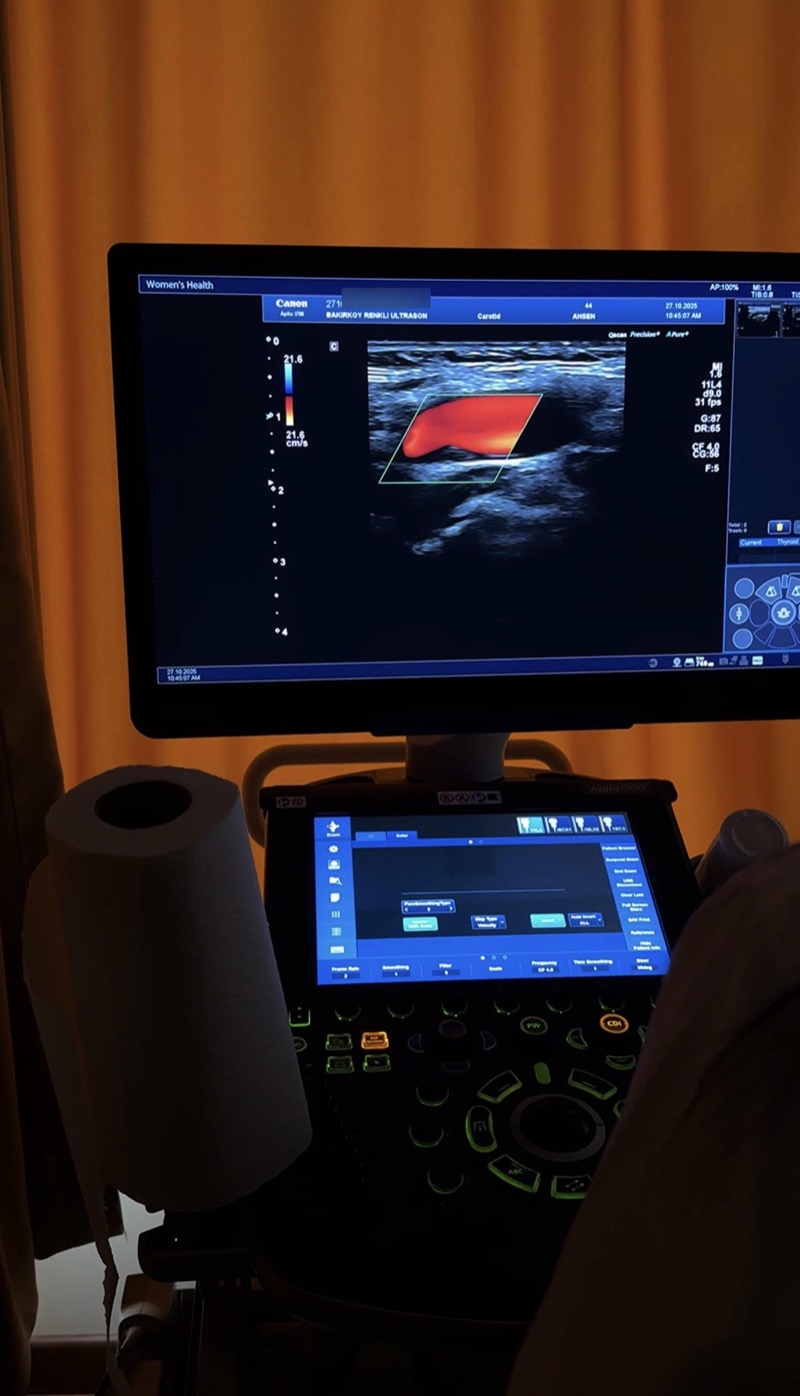 Karotis (şah damarı) renkli Doppler incelemesi