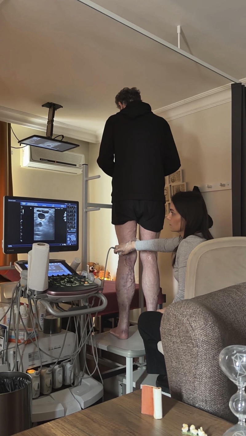 Varis değerlendirmesi — ayakta venöz Doppler incelemesi